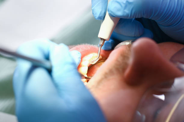 Best After-Hours Dental Trauma Care in Camden, OH
