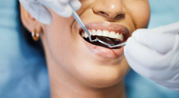 Best Emergency Dental Care for Broken or Chipped Teeth in Camden, OH