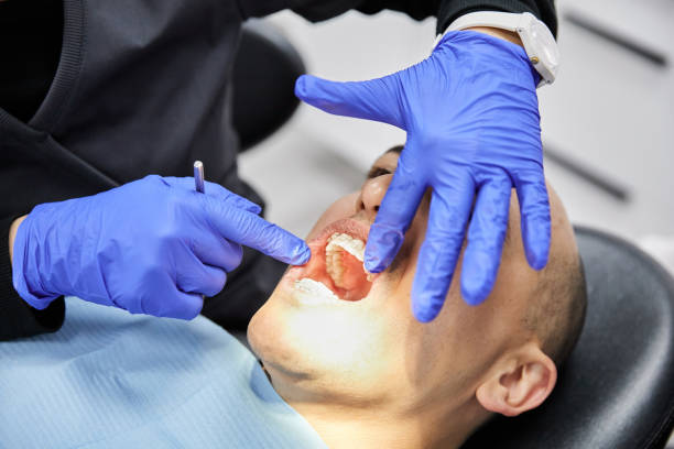 Best Emergency Treatment for Dental Infections or Abscesses in Camden, OH